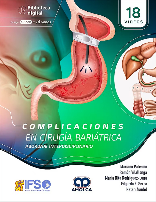 COMPLICACIONES EN CIRUGIA BARIATRICA ABORDAJE INTENSIVO 